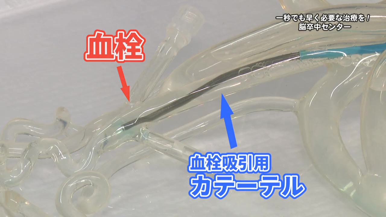 一秒でも早く必要な治療を！　脳卒中センター