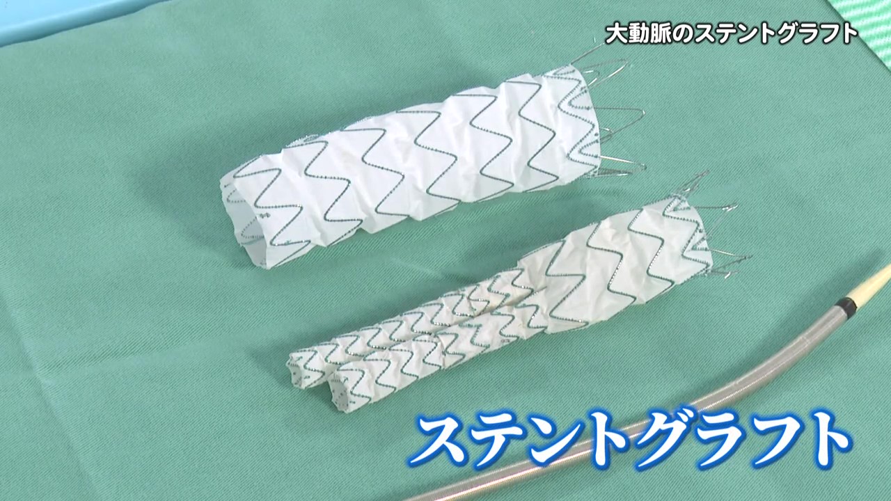 一秒でも早く必要な治療を！　脳卒中センター