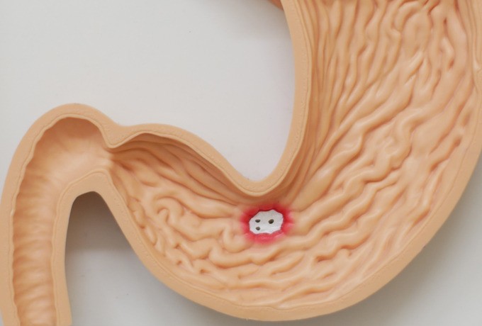 大腸CT検査