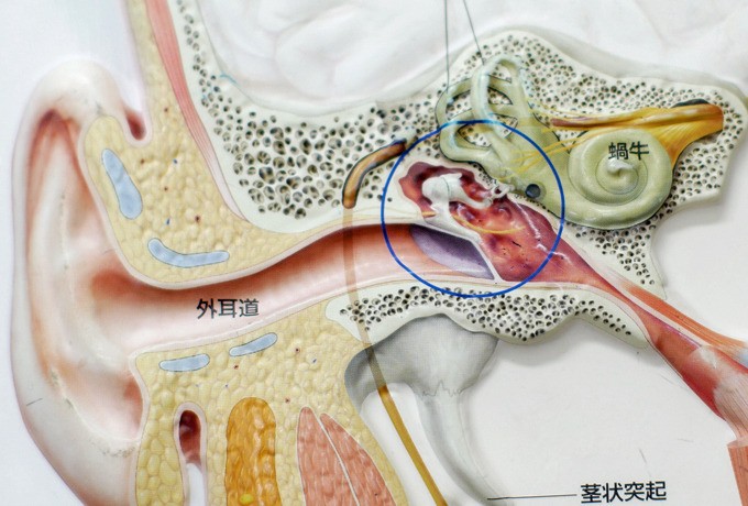 睡眠時無呼吸症候群の検査と治療